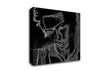 Sid Canvas Wall Art