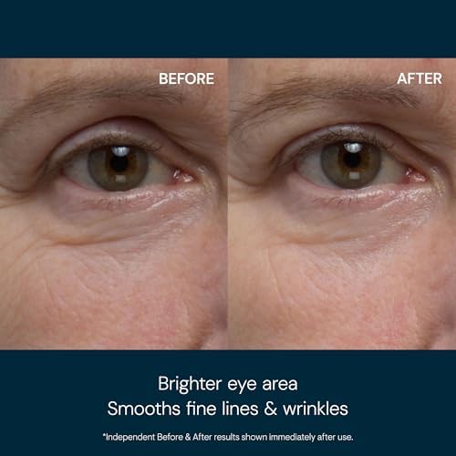 ELEMIS Pro-Collagen Eye Treatment, Eye Revive Mask, Vitality Eye Cream, Under Eye Gel Mask – Anti-Aging, Hydrating & Brightening Skincare for Puffiness, Dark Circles & Fine Line