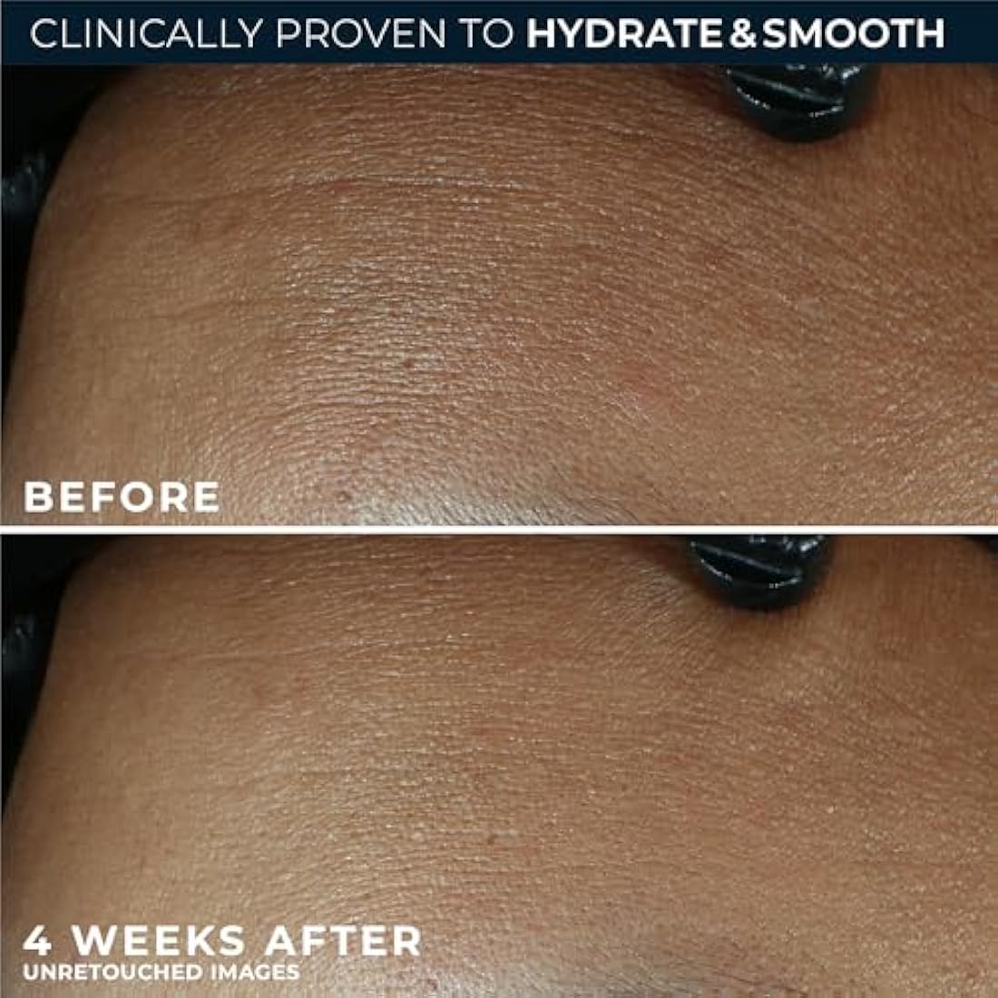 RoC Retinol Correxion Anti-Aging Crème for 24-Hour Deep Hydration, Advanced Anti-Wrinkle Moisturizer Made with Retinol & Hyaluronic Acid 1.7 oz