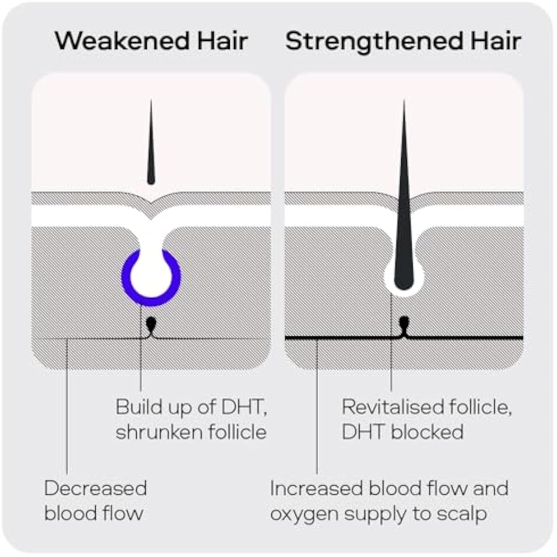 Sons Minoxidil 5%, Strengthening Shampoo and Dermaroller for Men. Hair Regrowth Treatment. Hair Growth Shampoo With Caffeine. Thickening, Anti-Dandruff, DHT Blocker. 3 Month Supply. Made in Europe.