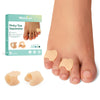 Welnove Gel Toe Separator - 8 Pack Pinky Toe Spacers - Little Toe Cushions, Small Toe Sleeves for Preventing Rubbing & Reducing Pressure (Beige)