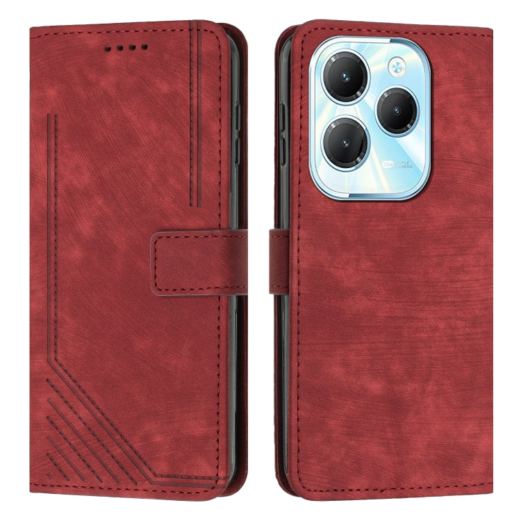 Skin Feel Stripe Pattern Leather Phone Case with Lanyard, For Infinix Note 40 4G, For Infinix Hot 40 / 40 Pro, For Infinix Hot 40i, For Infinix Smart 8