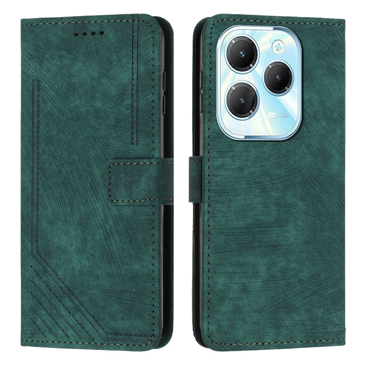 Skin Feel Stripe Pattern Leather Phone Case with Lanyard, For Infinix Note 40 4G, For Infinix Hot 40 / 40 Pro, For Infinix Hot 40i, For Infinix Smart 8