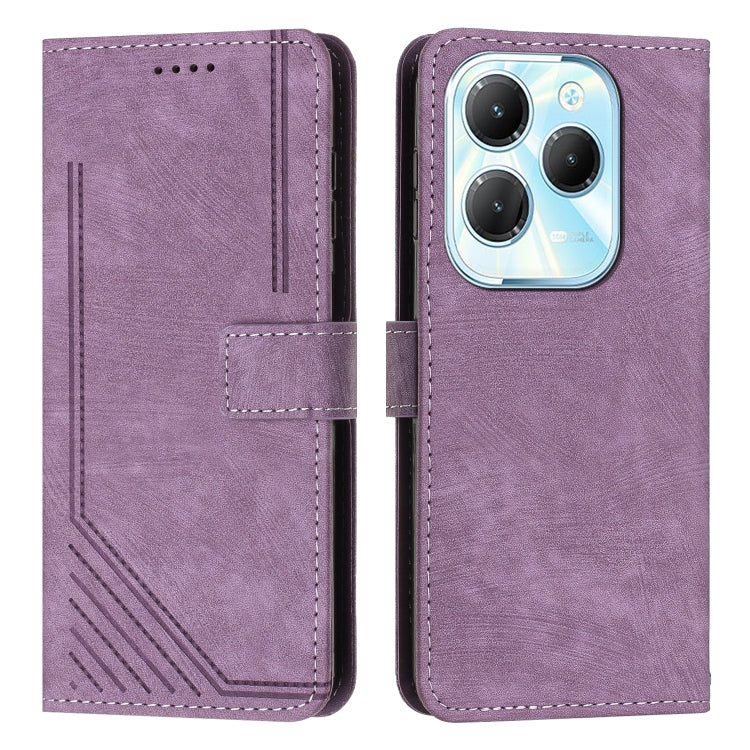 Skin Feel Stripe Pattern Leather Phone Case with Lanyard, For Infinix Note 40 4G, For Infinix Hot 40 / 40 Pro, For Infinix Hot 40i, For Infinix Smart 8