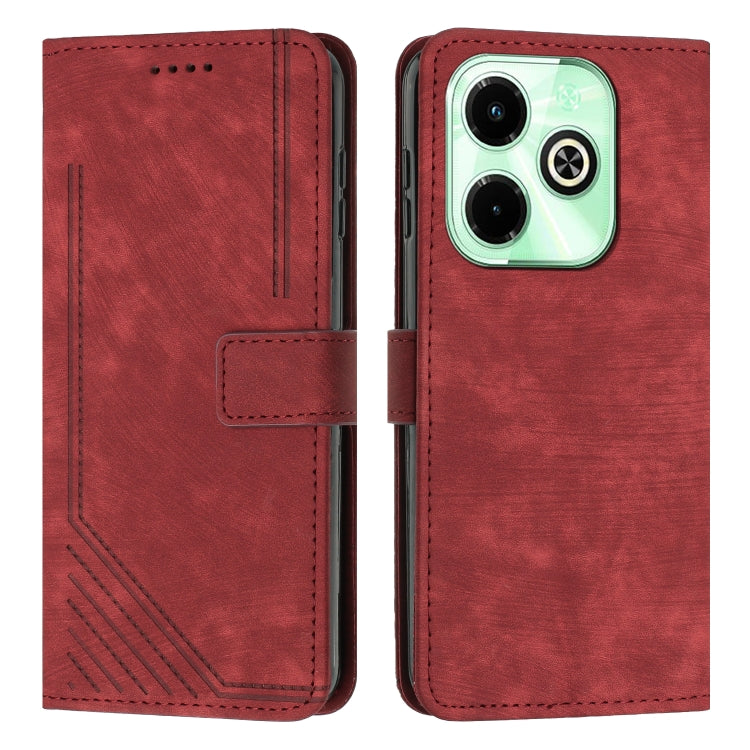 Skin Feel Stripe Pattern Leather Phone Case with Lanyard, For Infinix Note 40 4G, For Infinix Hot 40 / 40 Pro, For Infinix Hot 40i, For Infinix Smart 8