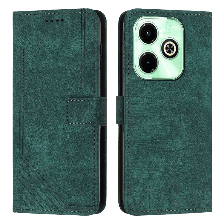 Skin Feel Stripe Pattern Leather Phone Case with Lanyard, For Infinix Note 40 4G, For Infinix Hot 40 / 40 Pro, For Infinix Hot 40i, For Infinix Smart 8