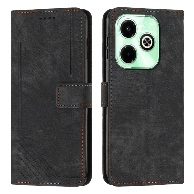 Skin Feel Stripe Pattern Leather Phone Case with Lanyard, For Infinix Note 40 4G, For Infinix Hot 40 / 40 Pro, For Infinix Hot 40i, For Infinix Smart 8