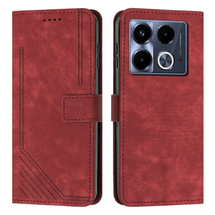 Skin Feel Stripe Pattern Leather Phone Case with Lanyard, For Infinix Note 40 4G, For Infinix Hot 40 / 40 Pro, For Infinix Hot 40i, For Infinix Smart 8